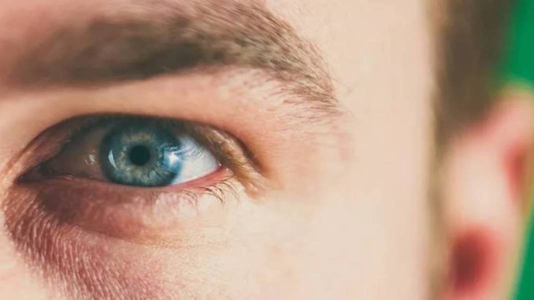 Gözünüz renkliyse dikkat! Büyük sır ortaya çıktı: Meğer o genetik özellik... 2